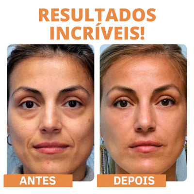 Kit Máscara GoldBotox | + SPRAY DE BRINDE| Frete Grátis