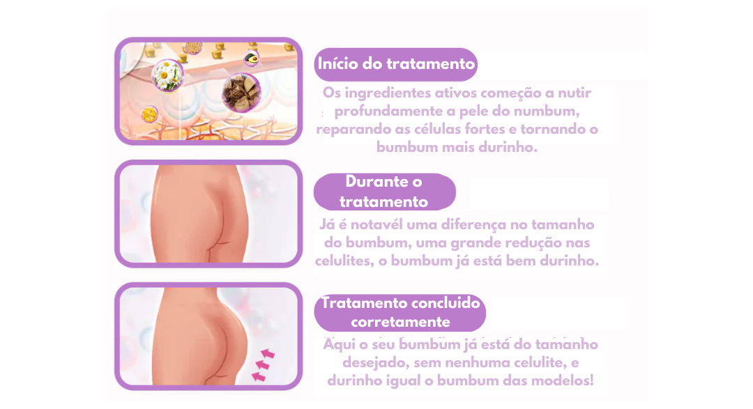 Creme Aumeta Bumbum Contra Celulites Empina Bumbum Bottom Cream™