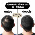 Sérum de crescimento capilar - alecrim, abacate e rícino