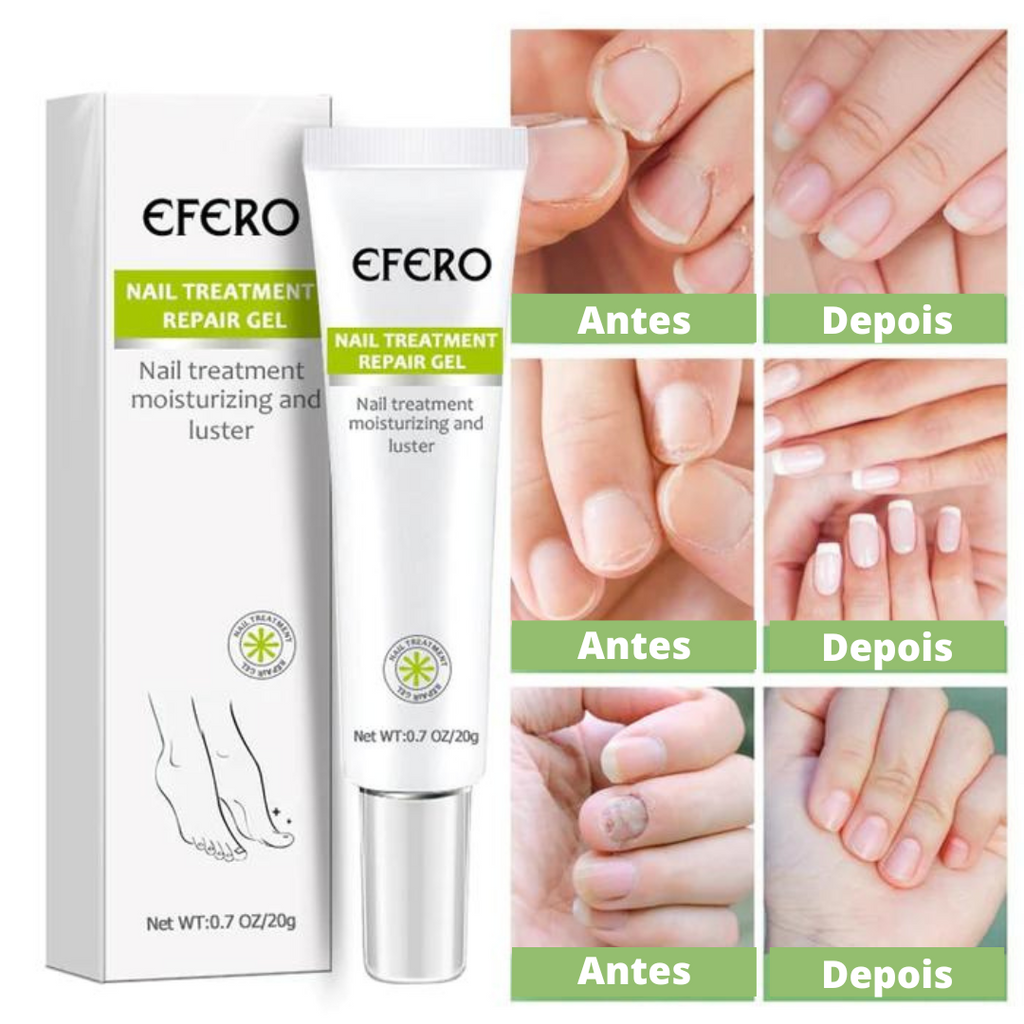 Pomada Efero Anti Fungos Unhas Encravadas |COMPRE 1 LEVE 2| Frete Grátis