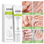 Pomada Efero Anti Fungos Unhas Encravadas |COMPRE 1 LEVE 2| Frete Grátis