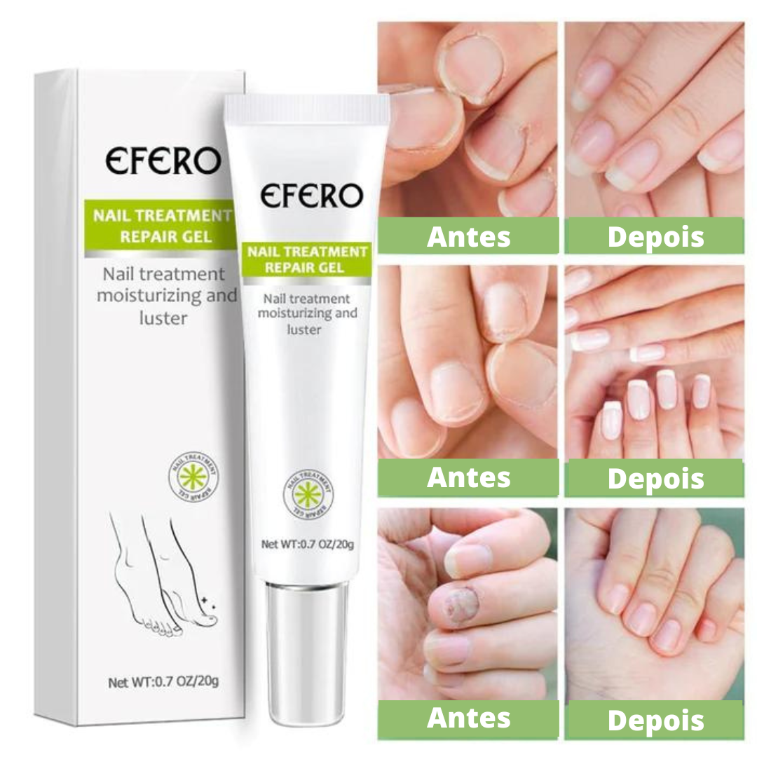 Pomada Efero Anti Fungos Unhas Encravadas |COMPRE 1 LEVE 2| Frete Grátis