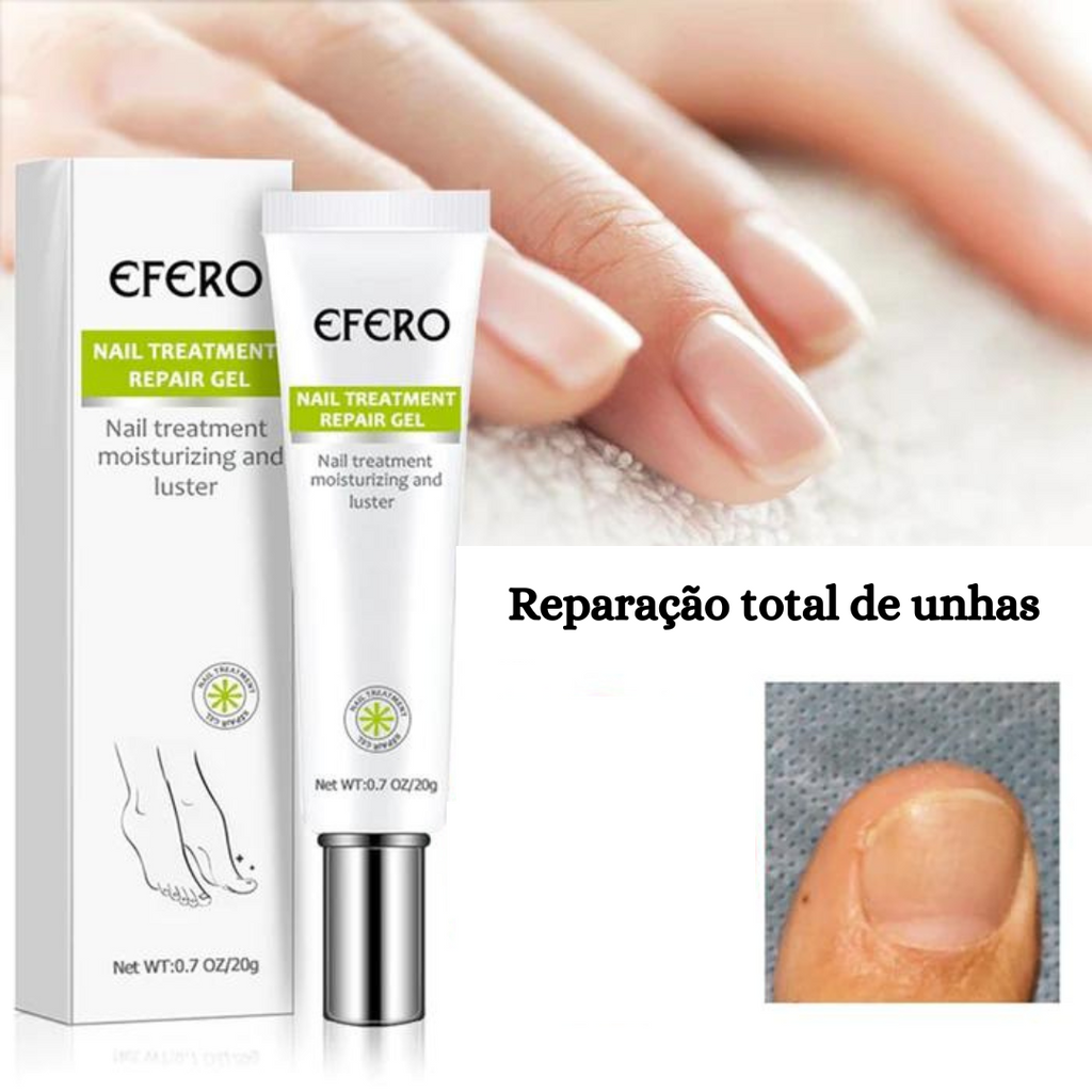 Pomada Efero Anti Fungos Unhas Encravadas |COMPRE 1 LEVE 2| Frete Grátis
