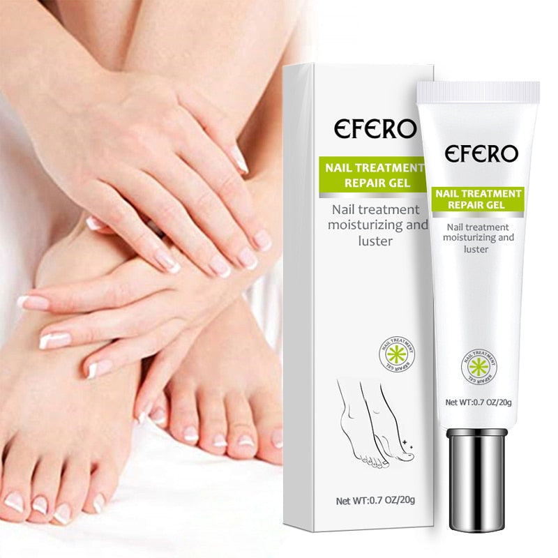 Pomada Efero Anti Fungos Unhas Encravadas |COMPRE 1 LEVE 2| Frete Grátis