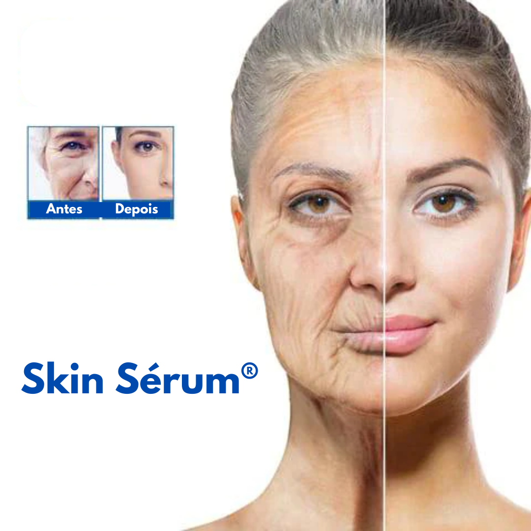 Sérum para Celulite, Estrias, Flacidez e Rugas - SkinSérum®
