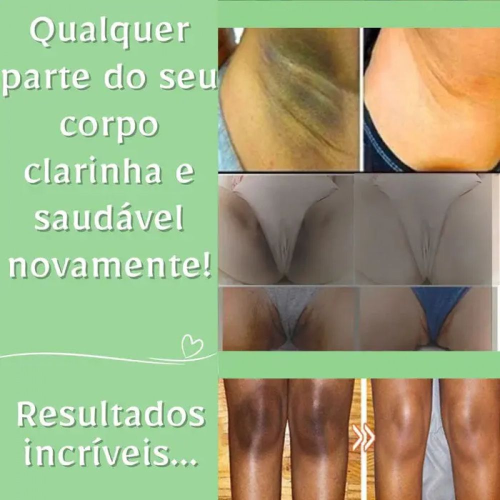 Creme Clareador de Manchas Escuras Retinol (Frete Grátis)