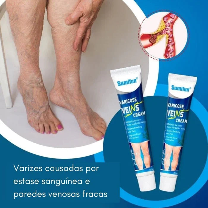 Varicose Veins, Diga adeus para suas Varizes e Inchaços |COMPRE 1 LEVE 2| + Frete Grátis