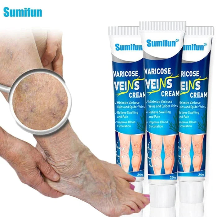 Varicose Veins, Diga adeus para suas Varizes e Inchaços |COMPRE 1 LEVE 2| + Frete Grátis